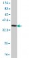 NR4A2 Antibody (monoclonal) (M07)