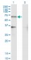 NR4A2 Antibody (monoclonal) (M07)