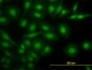 NR4A2 Antibody (monoclonal) (M08)