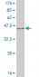 NR4A2 Antibody (monoclonal) (M08)