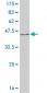 NR4A2 Antibody (monoclonal) (M08)