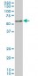 NR4A2 Antibody (monoclonal) (M08)