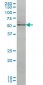 NR4A2 Antibody (monoclonal) (M08)