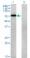 NR4A2 Antibody (monoclonal) (M08)