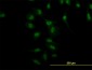 NR4A2 Antibody (monoclonal) (M10)
