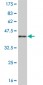 NR4A2 Antibody (monoclonal) (M10)