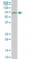 NR4A2 Antibody (monoclonal) (M10)