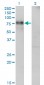 NR4A2 Antibody (monoclonal) (M10)