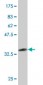 NR4A3 Antibody (monoclonal) (M02)