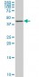 NR4A3 Antibody (monoclonal) (M02)