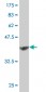 NUDT1 Antibody (monoclonal) (M02)