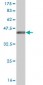 NUDT5 Antibody (monoclonal) (M04)