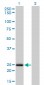 NUDT5 Antibody (monoclonal) (M04)