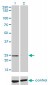 NUDT5 Antibody (monoclonal) (M04)