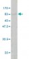 NUP62 Antibody (monoclonal) (M01)