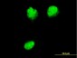 NUP62 Antibody (monoclonal) (M02)