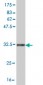 OCRL Antibody (monoclonal) (M02)
