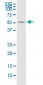 ODC1 Antibody (monoclonal) (M01)