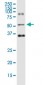 ODC1 Antibody (monoclonal) (M01)