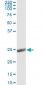 ORM1 Antibody (monoclonal) (M01)