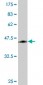ORM1 Antibody (monoclonal) (M01)