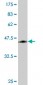 ORM1 Antibody (monoclonal) (M01)