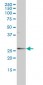 ORM1 Antibody (monoclonal) (M01)