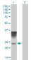 ORM1 Antibody (monoclonal) (M01)