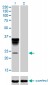 ORM1 Antibody (monoclonal) (M01)