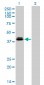 OTX1 Antibody (monoclonal) (M01)