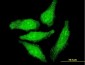 OTX1 Antibody (monoclonal) (M07)