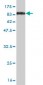 OXSR1 Antibody (monoclonal) (M18)