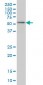 OXSR1 Antibody (monoclonal) (M18)