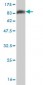 OXSR1 Antibody (monoclonal) (M19)