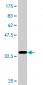 P15RS Antibody (monoclonal) (M02)