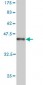 P2RX5 Antibody (monoclonal) (M01)