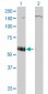P2RX5 Antibody (monoclonal) (M01)