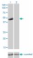 P2RX5 Antibody (monoclonal) (M01)