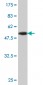 PAFAH1B3 Antibody (monoclonal) (M08)