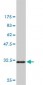 PAK1 Antibody (monoclonal) (M02)