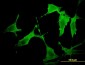 PAK3 Antibody (monoclonal) (M07)