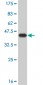 PAK3 Antibody (monoclonal) (M07)