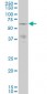 PAK3 Antibody (monoclonal) (M07)