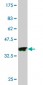 PAK3 Antibody (monoclonal) (M08)