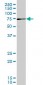 PAK3 Antibody (monoclonal) (M08)