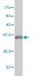 PAPSS2 Antibody (monoclonal) (M07)