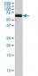 PAPSS2 Antibody (monoclonal) (M07)