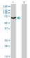 PAPSS2 Antibody (monoclonal) (M07)