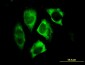 PARK2 Antibody (monoclonal) (M01)