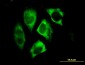 PARK2 Antibody (monoclonal) (M01)